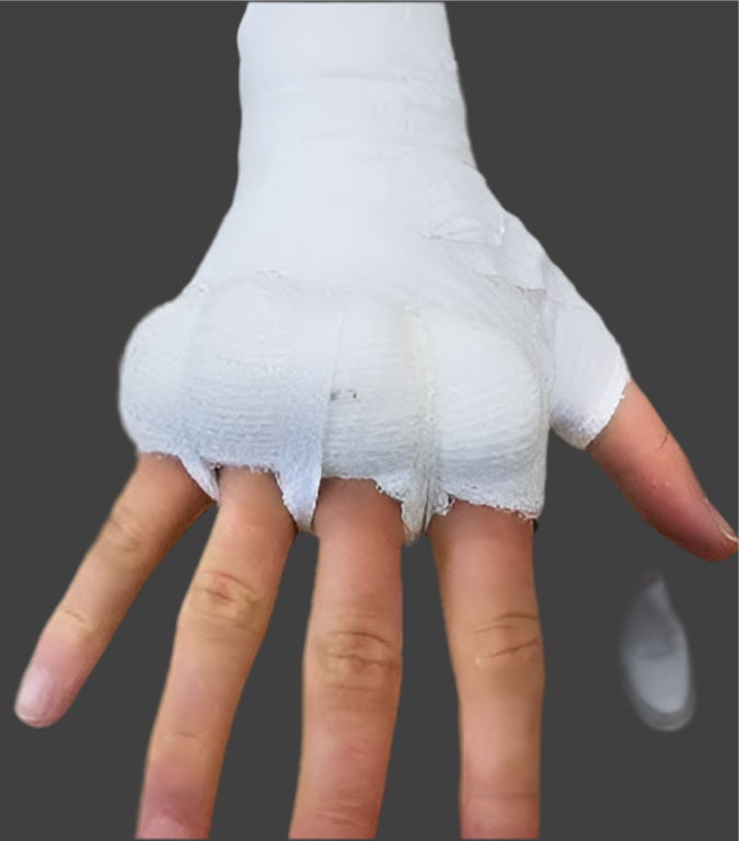 Medical Gauze 5 pack 5cm/7.5cm/10cm x 5m